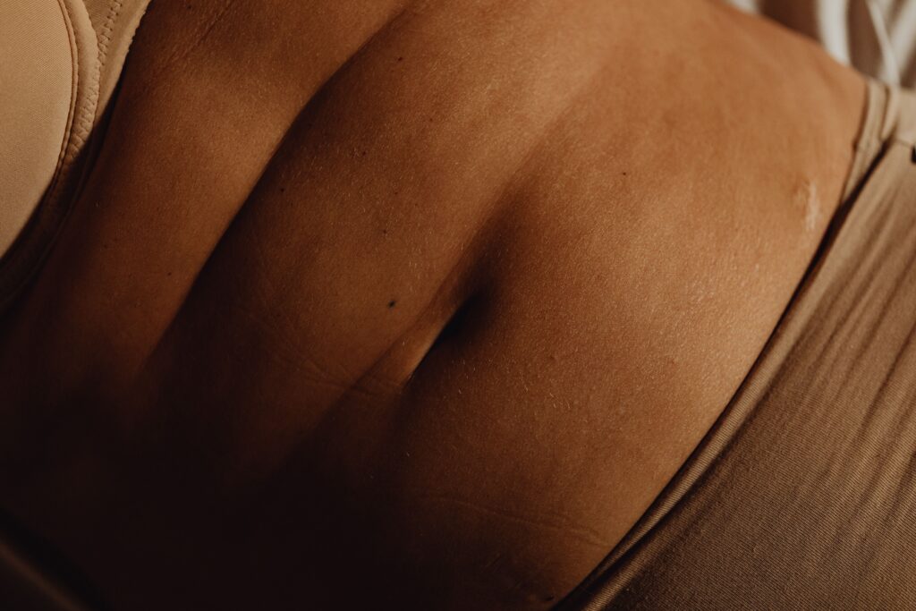 liposuctie